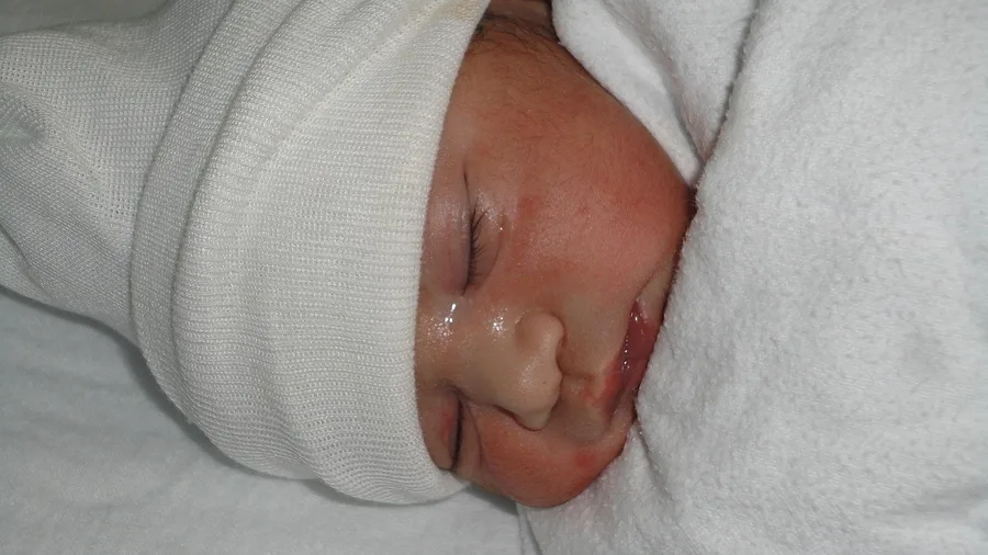 Birthright Citizenship Rules Are Under Active Review